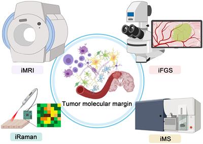 Advances in the intraoperative delineation of malignant glioma margin